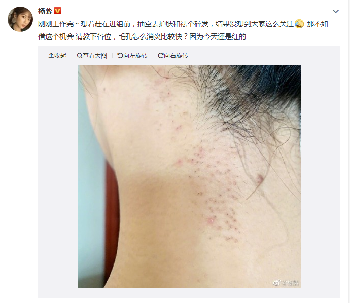 杨紫回应整容传闻