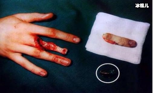 戴戒指打保龄球