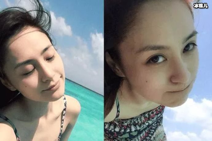 经历离婚风波后，阿娇再次出意外，头部受伤严重住院