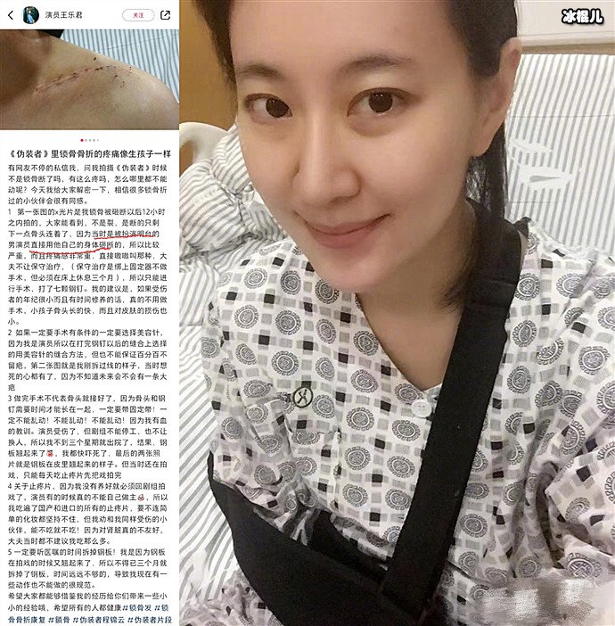 胡歌被曝拍伪装者时砸断女主锁骨