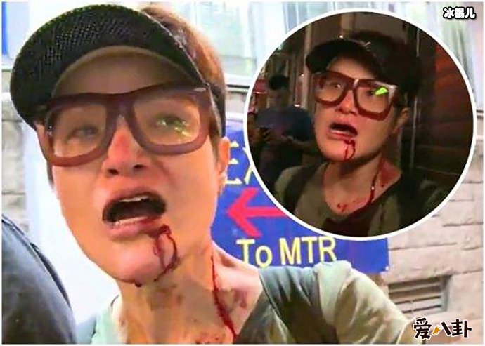 TVB女艺人马蹄露遭暴徒殴打