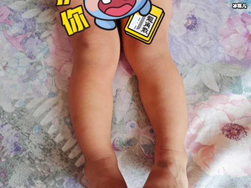 刚出生不久婴儿腿型不好看原因，用这几个方法就可以矫正！