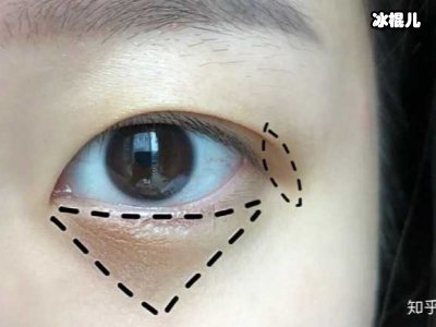 对黑眼圈Sayno，猫眼贴让你的双眸重新焕发光彩！