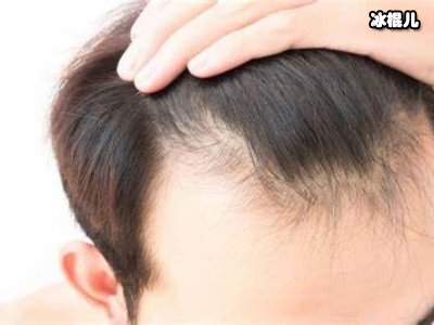 不花点心思在头上，小心“秃”然袭击