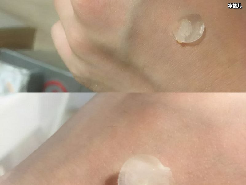 面对痘痘我们要对症下药，用祛痘面膜最奏效