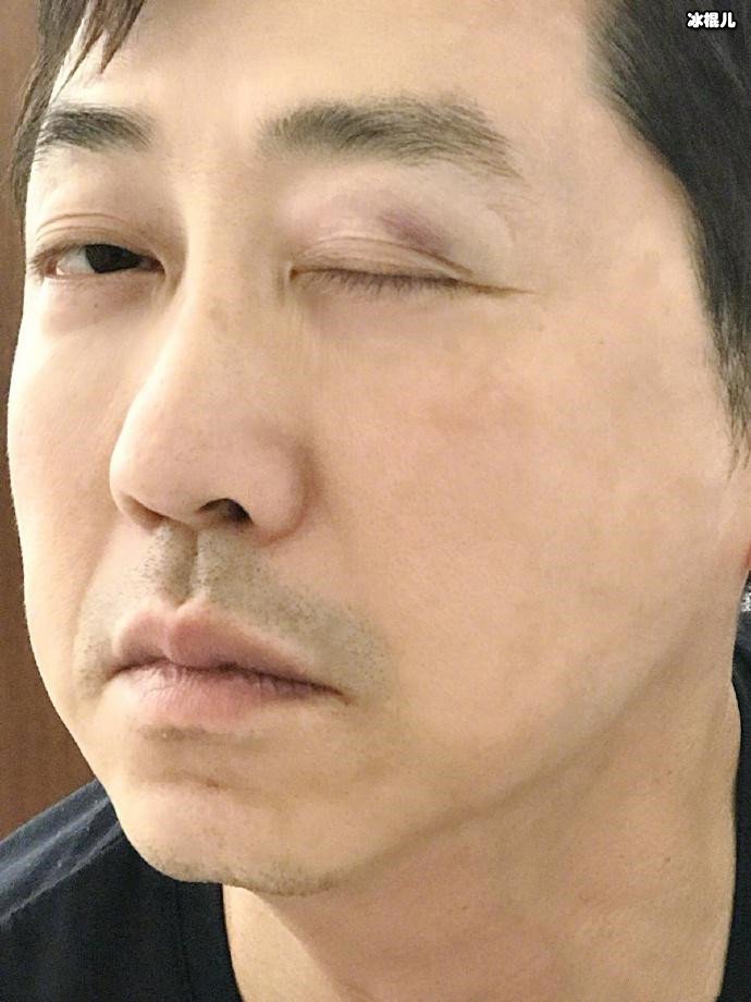手机伤眼睛(为什么关灯玩手机伤眼睛)