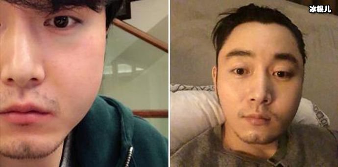 李东学毁容照片