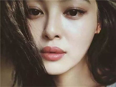 辛芷蕾嘴唇是怎么回事？是整容后遗症吗？