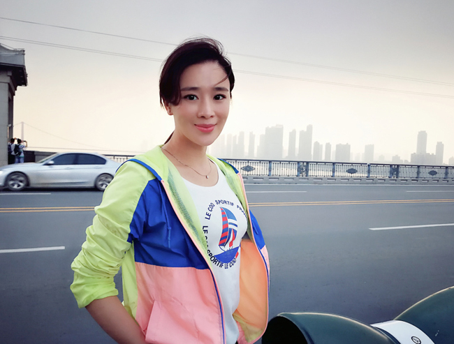 周显欣为什么这么丑长得怪怪的怎么回事鼻子整的吗揭秘