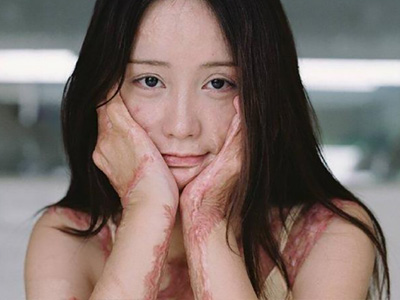周岩现况起底，如今因为面部问题导致抑郁？